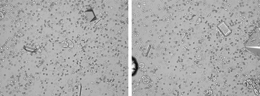 Lacie Urinary Crystal