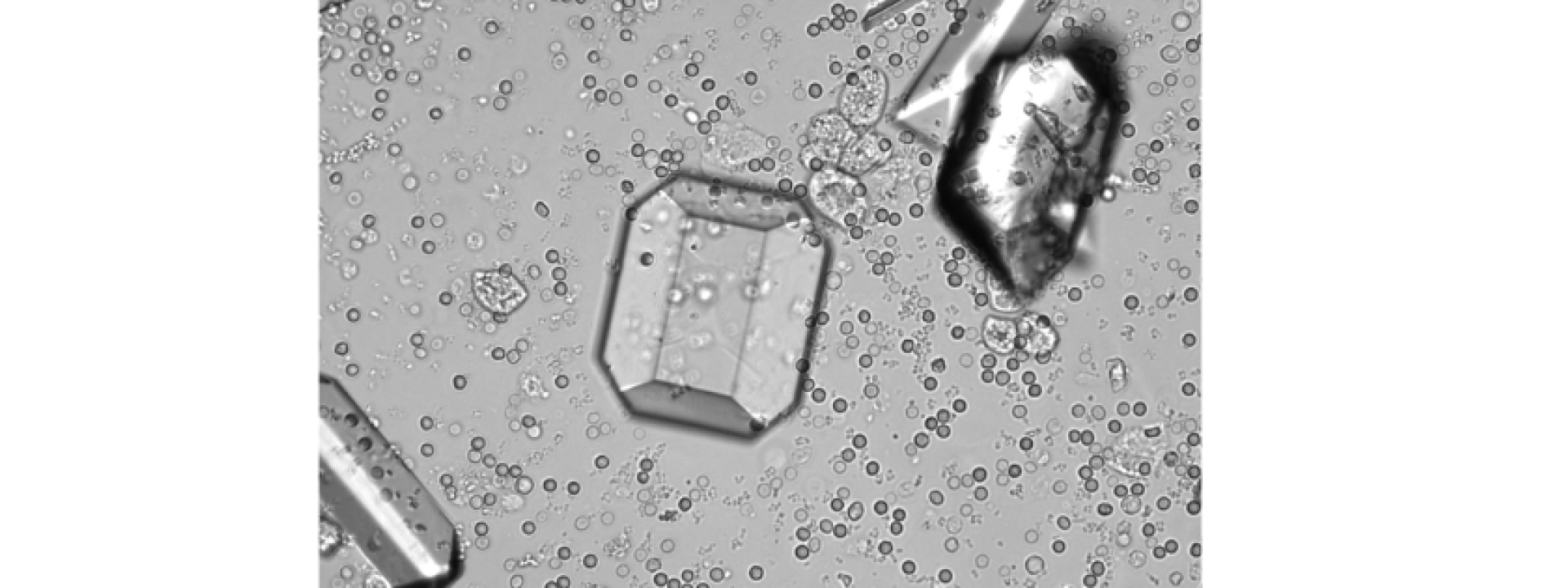 Urinary Crystals